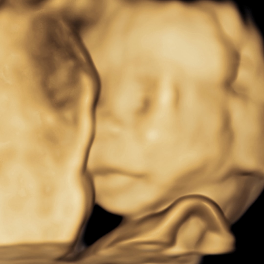 Photo shared by Cecily for their Babylist baby registry.