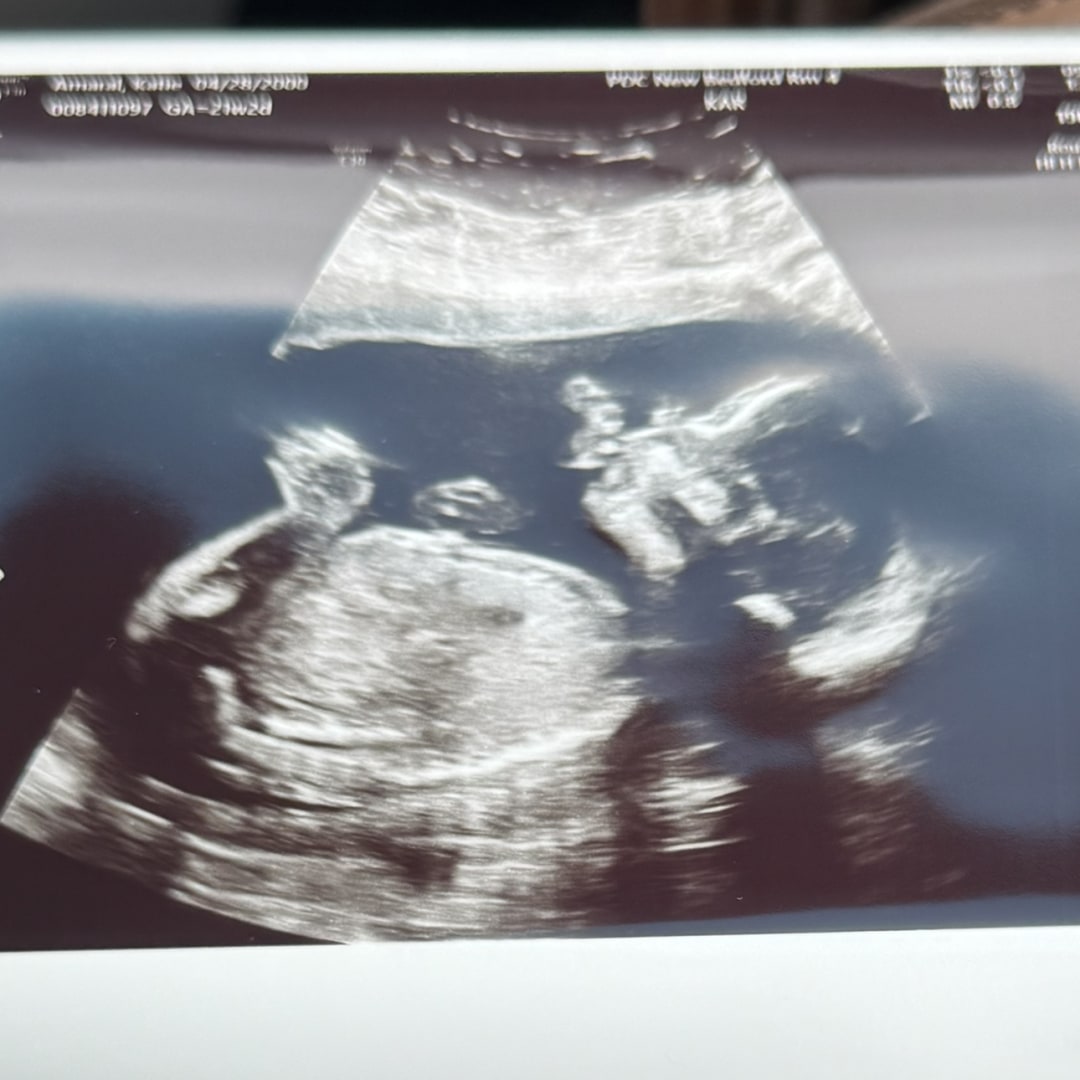 Photo shared by Katie for their Babylist baby registry.