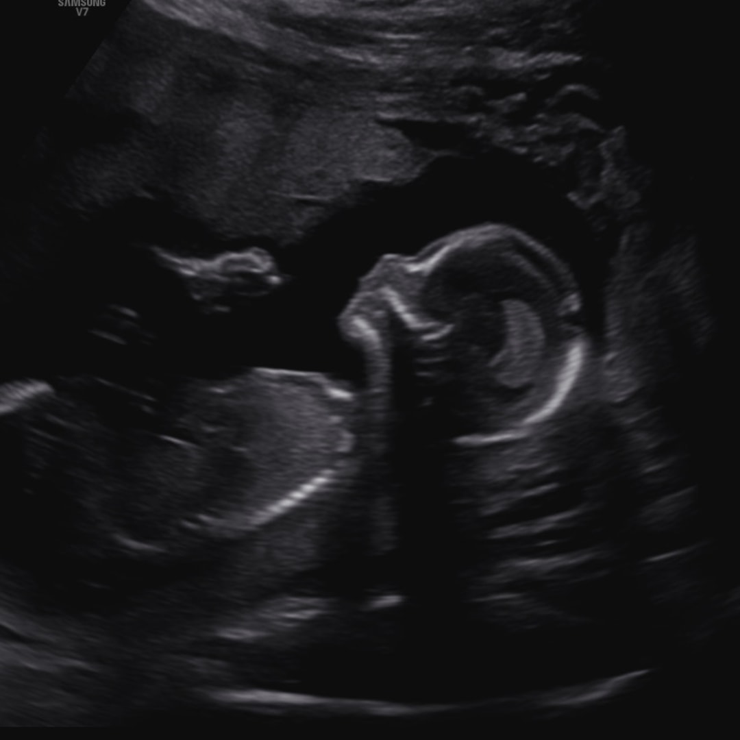 Photo shared by Crystal for their Babylist baby registry.
