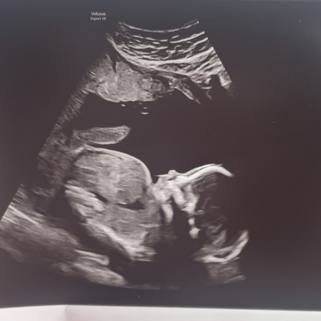 Photo shared by Madi for their Babylist baby registry.