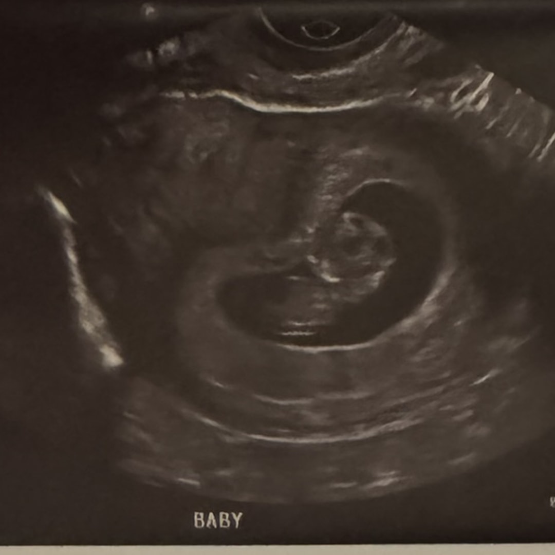 Photo shared by Jayda for their Babylist baby registry.