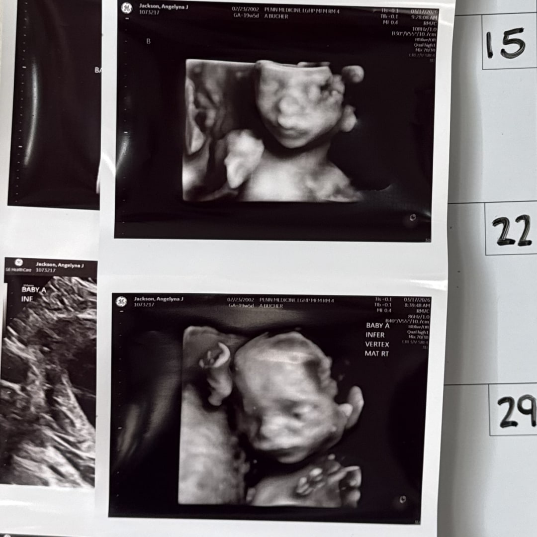 Photo shared by Angelyna for their Babylist baby registry.