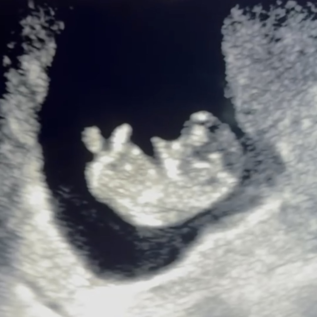 Photo shared by Melanie for their Babylist baby registry.