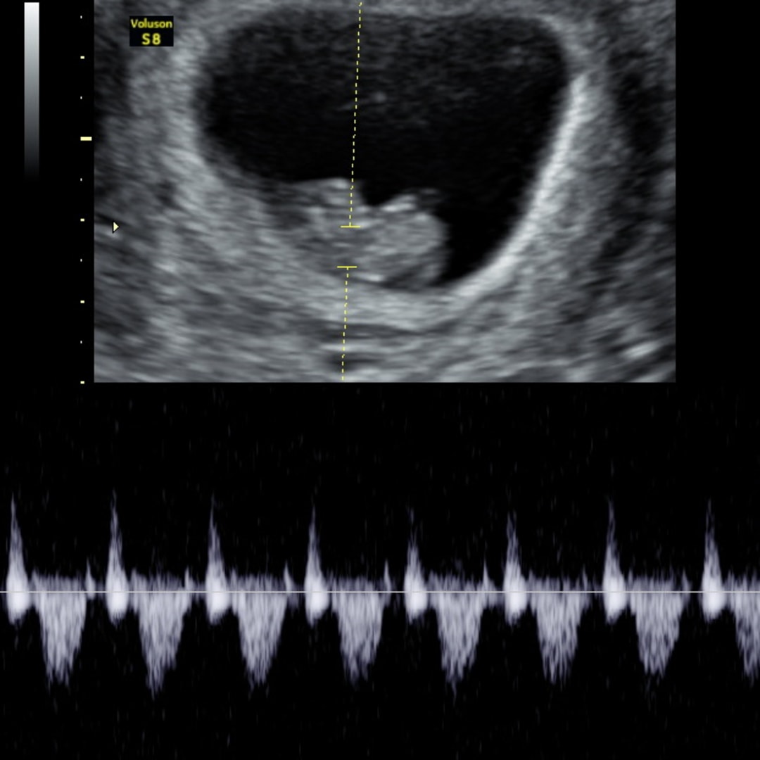 Photo shared by Evyr for their Babylist baby registry.