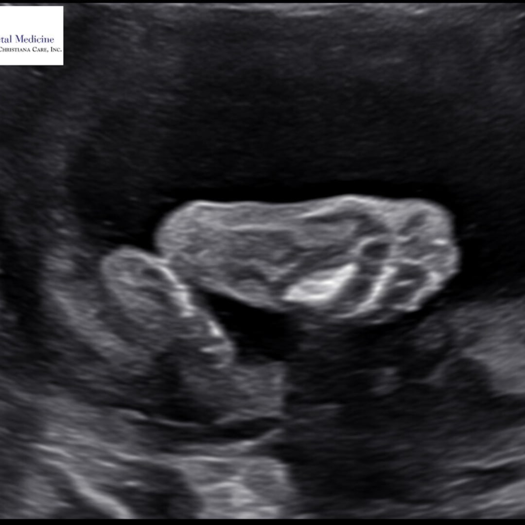 Photo shared by Kelsey for their Babylist baby registry.