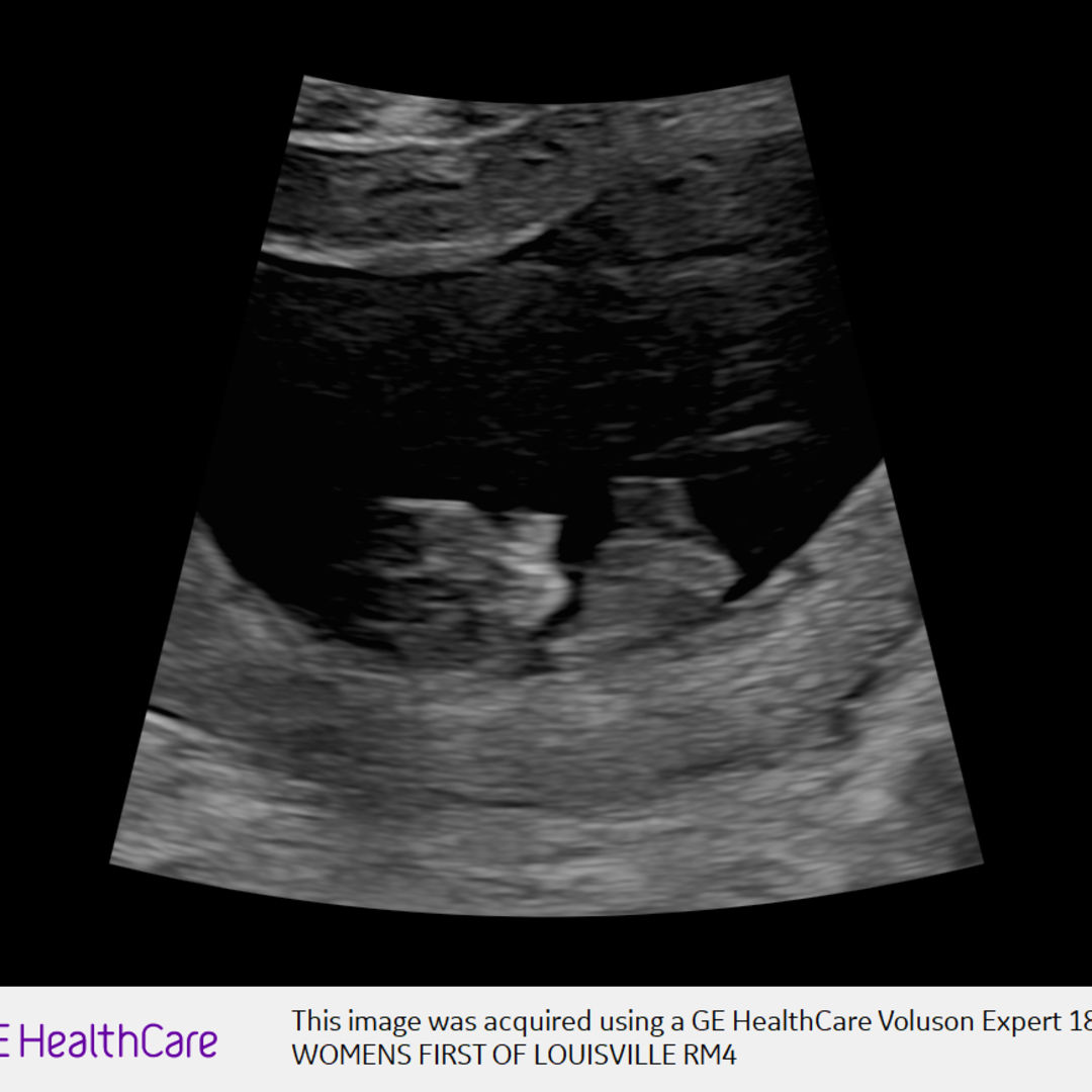 Photo shared by Sara for their Babylist baby registry.