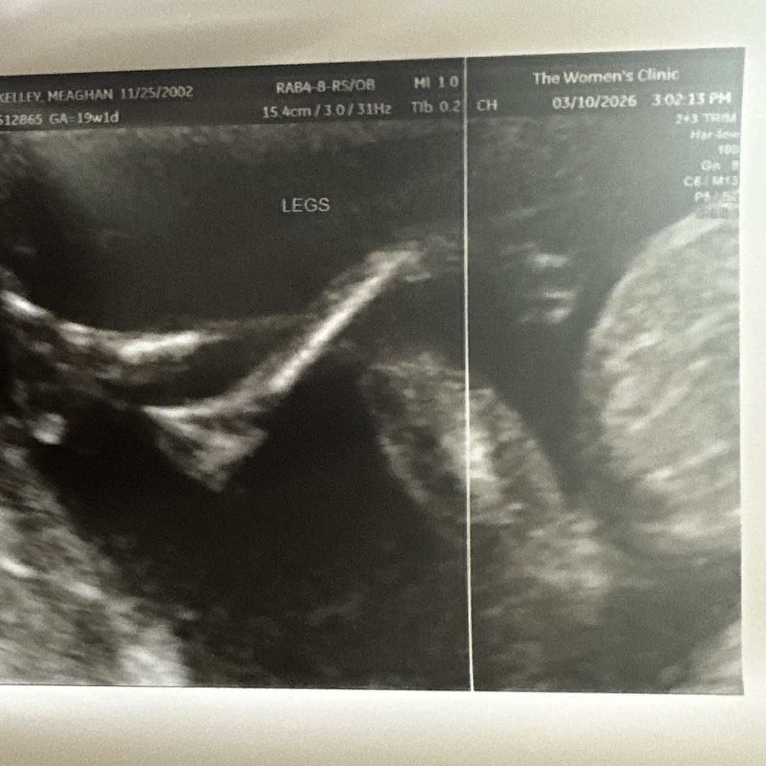 Photo shared by Meaghan for their Babylist baby registry.