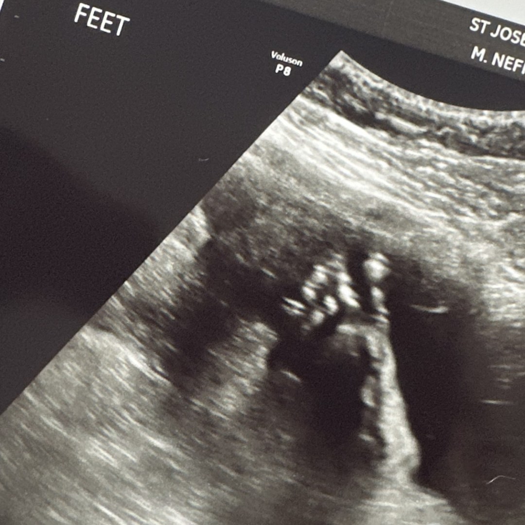 Photo shared by Niki for their Babylist baby registry.