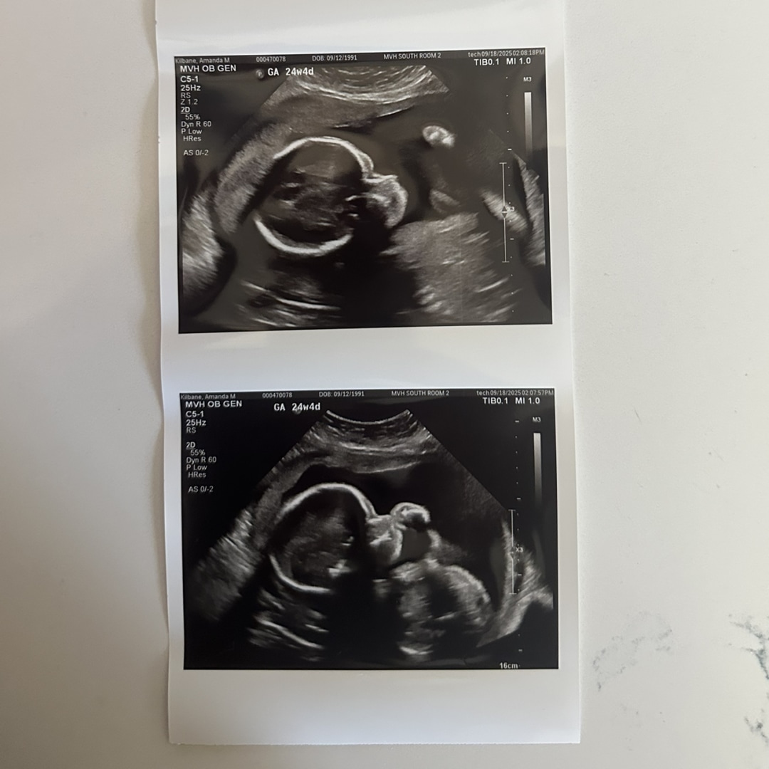 Photo shared by Amanda for their Babylist baby registry.