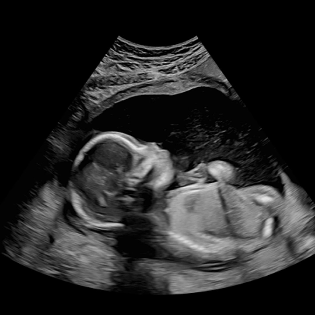 Photo shared by Rachel for their Babylist baby registry.