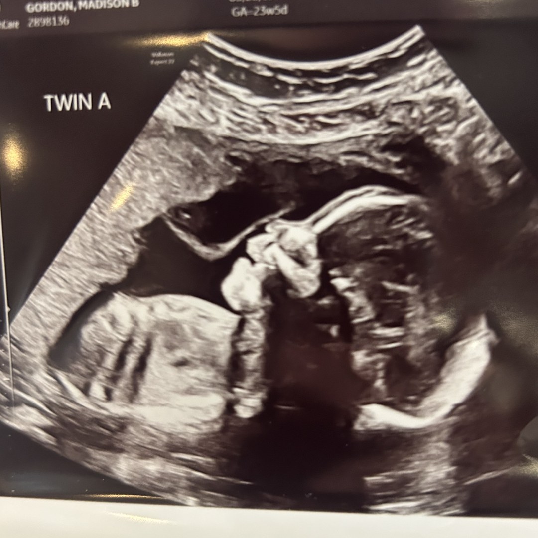 Photo shared by Madison for their Babylist baby registry.