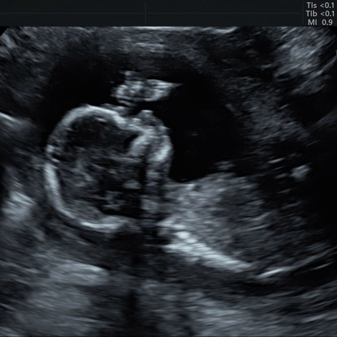 Photo shared by Melissa for their Babylist baby registry.