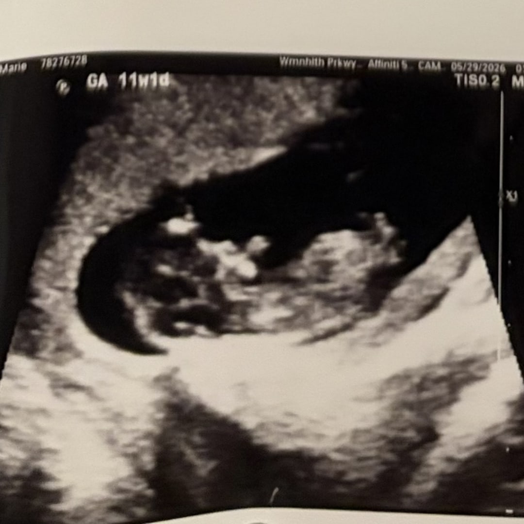 Photo shared by Sierra for their Babylist baby registry.
