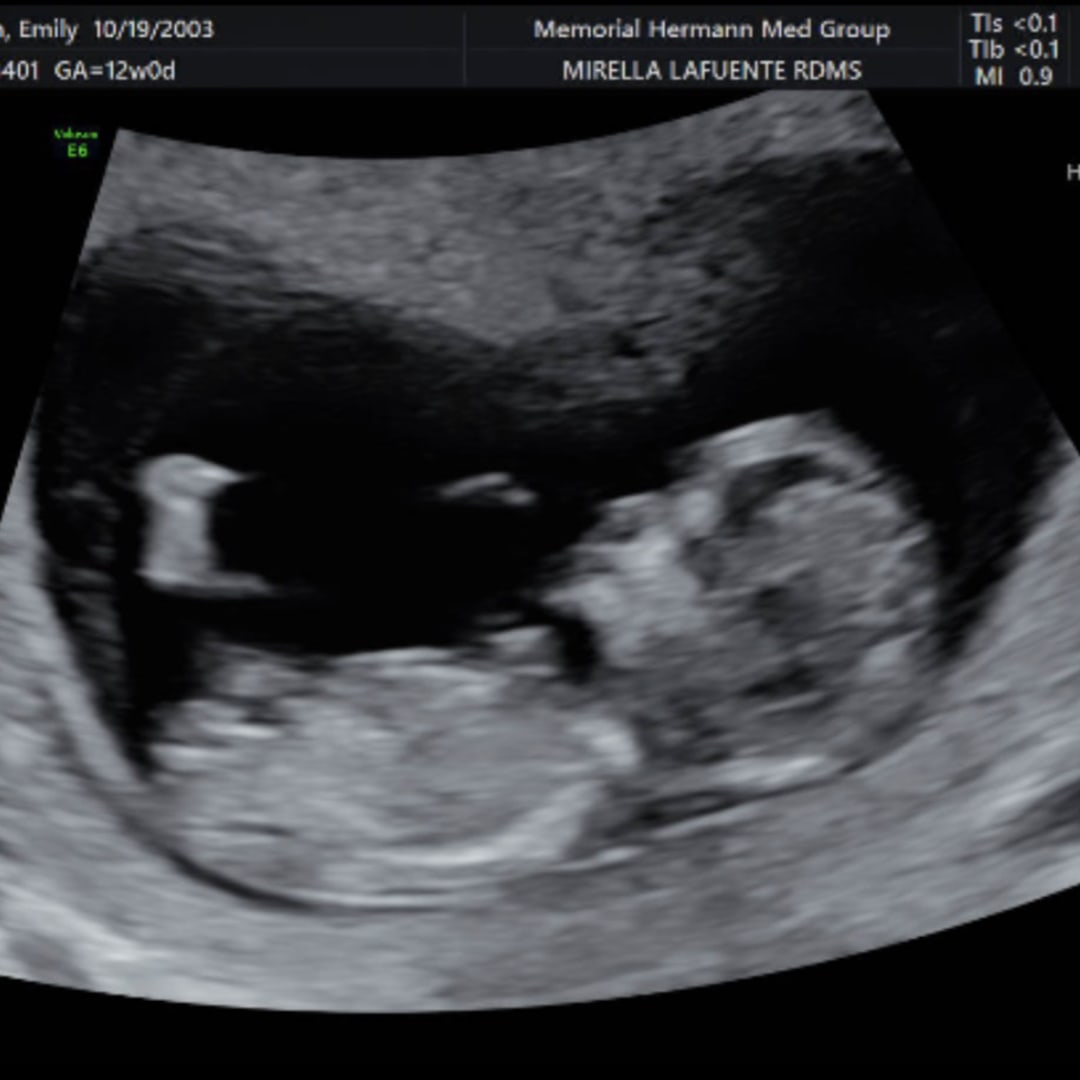 Photo shared by Emily for their Babylist baby registry.