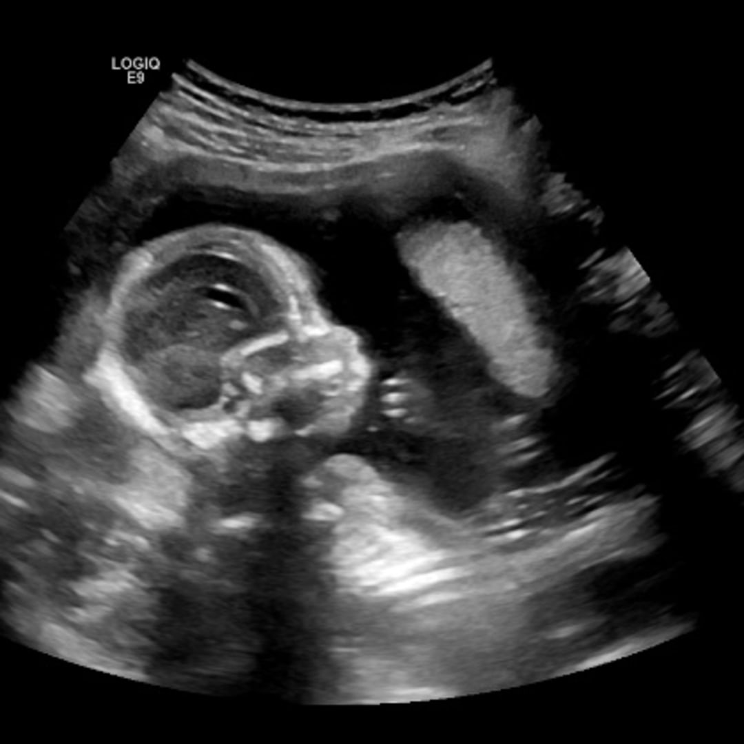 Photo shared by Melody for their Babylist baby registry.