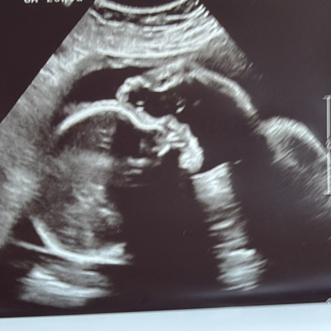 Photo shared by Annie for their Babylist baby registry.