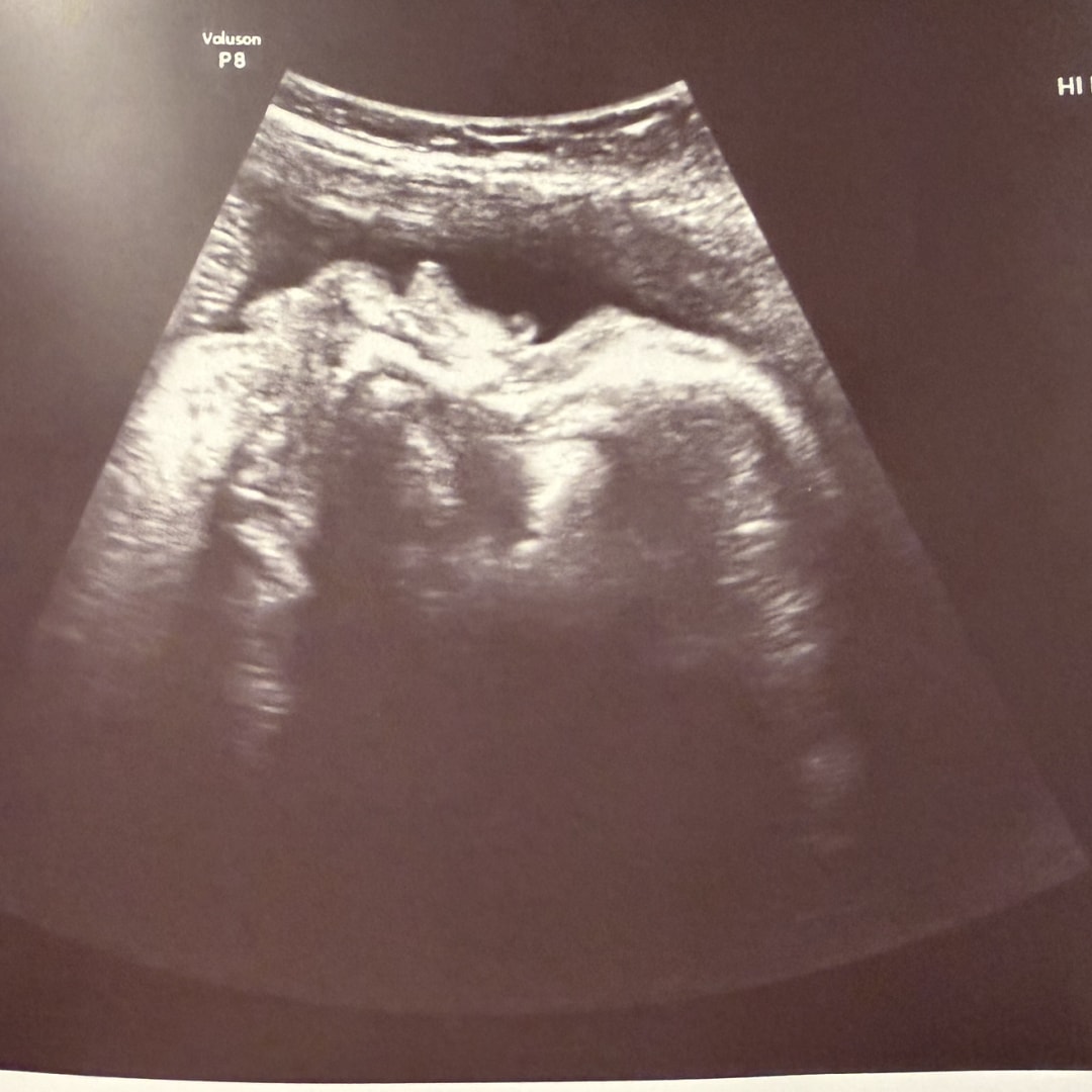 Photo shared by Maria for their Babylist baby registry.