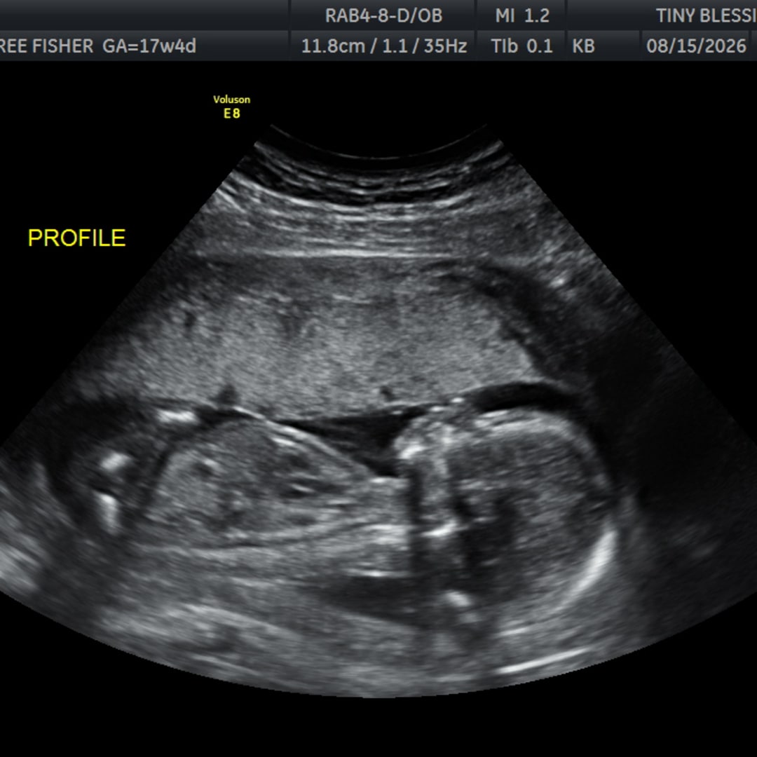 Photo shared by Cambree for their Babylist baby registry.