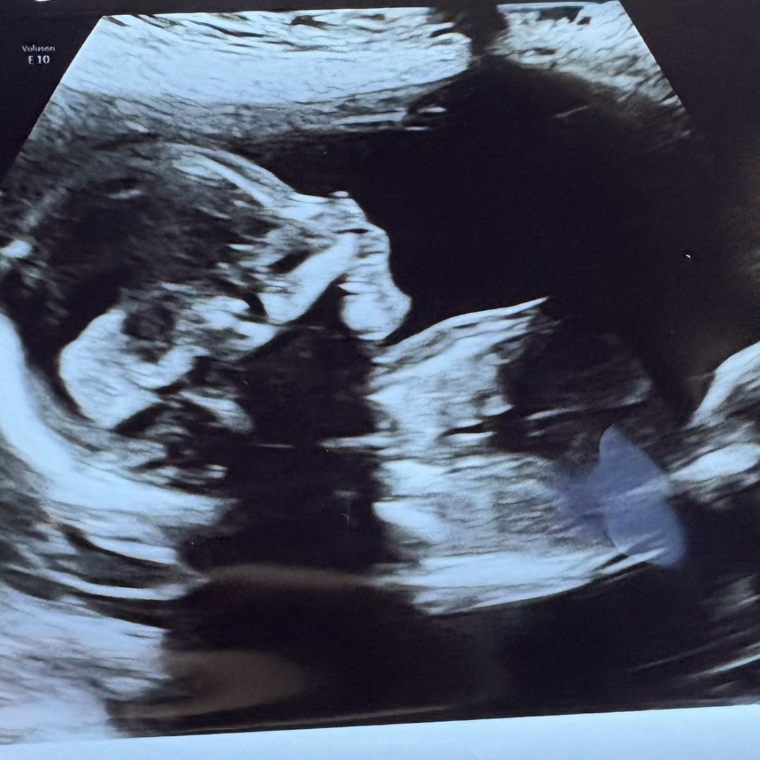Photo shared by Nayaira for their Babylist baby registry.