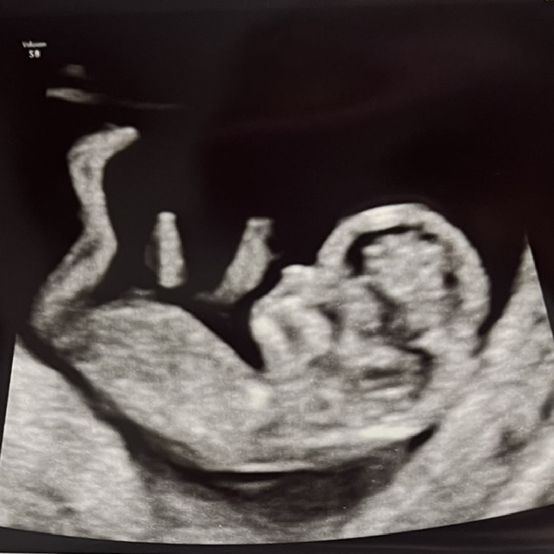 Photo shared by Amber for their Babylist baby registry.