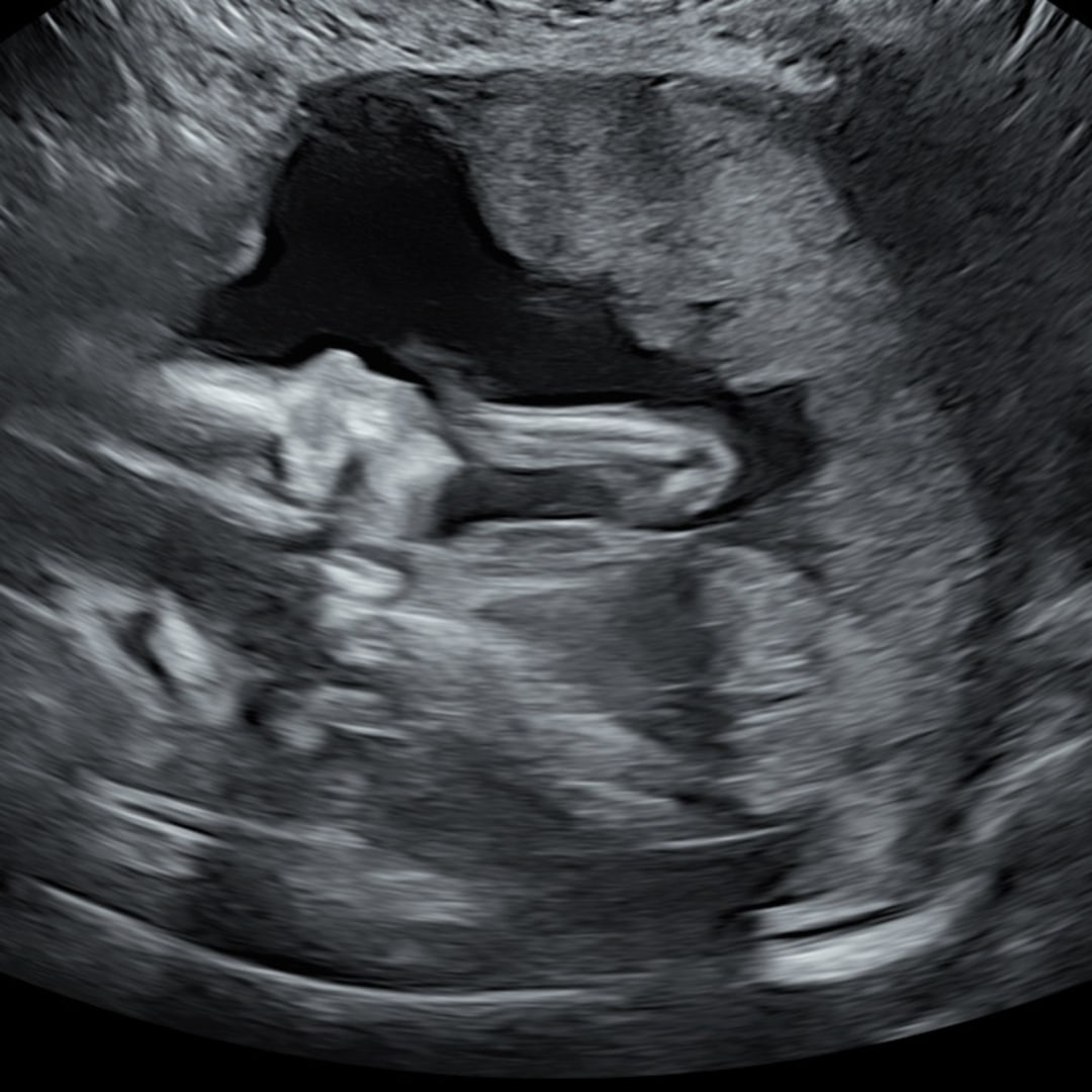 Photo shared by Daniel for their Babylist baby registry.