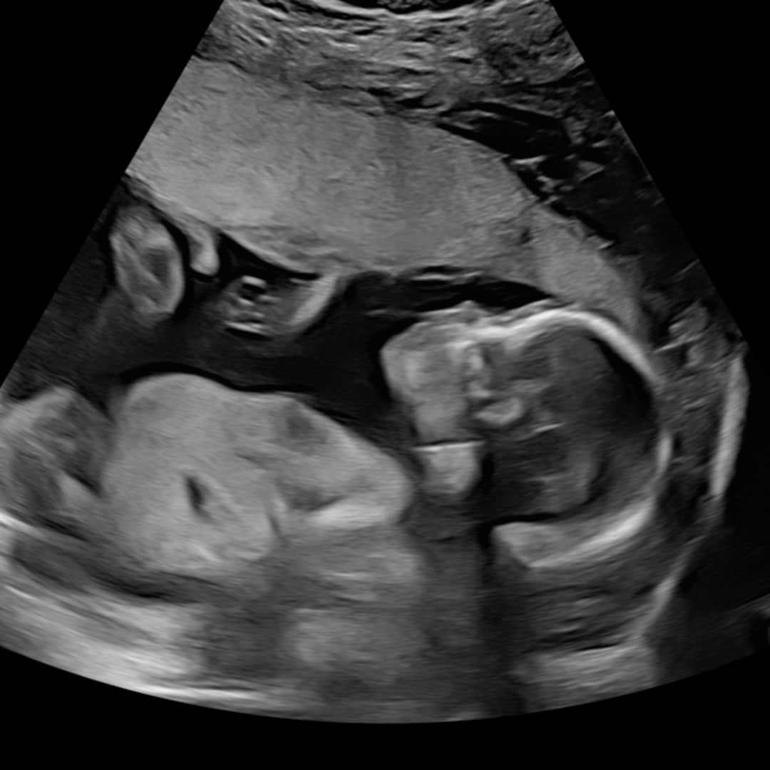 Photo shared by Abigail for their Babylist baby registry.