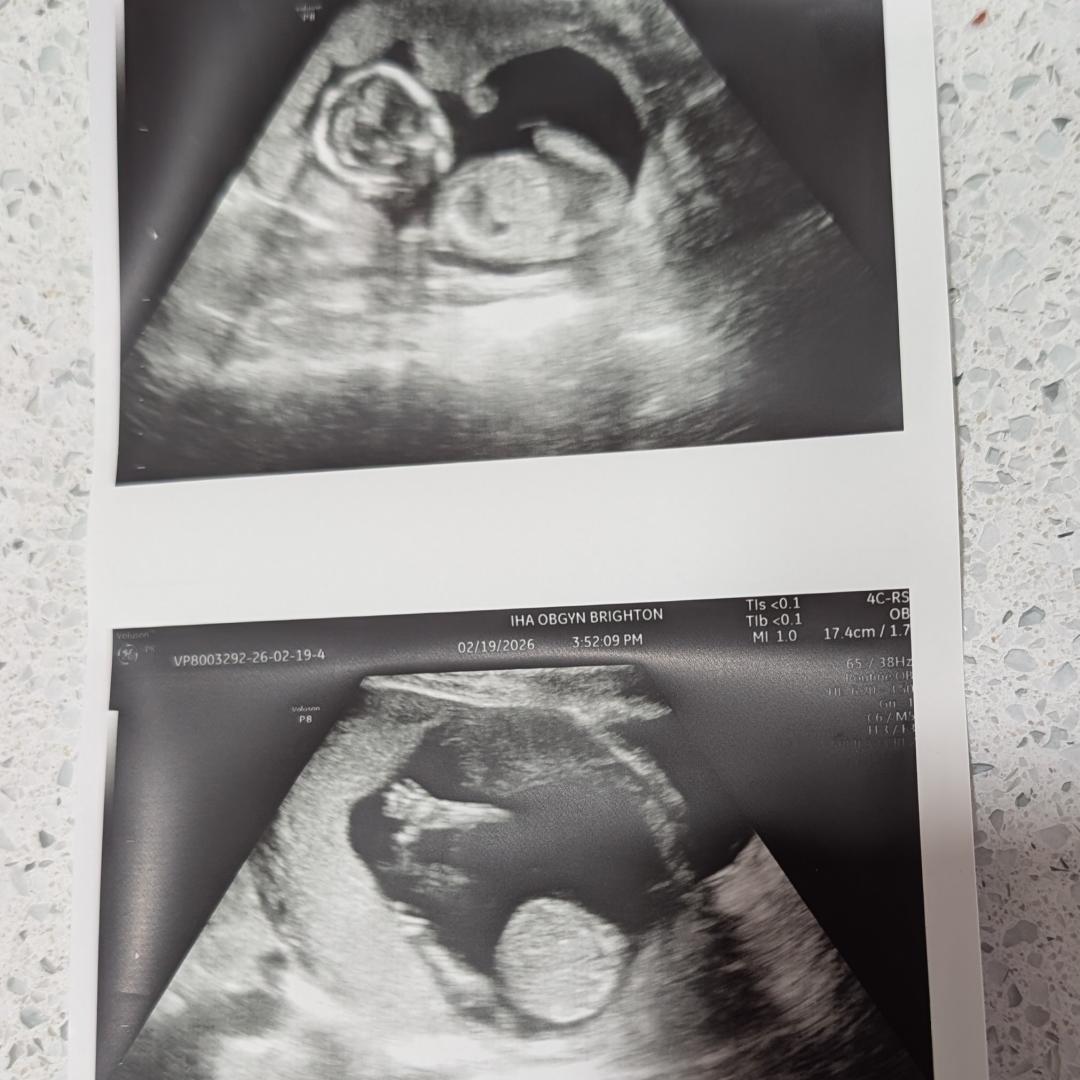 Photo shared by Amanda for their Babylist baby registry.