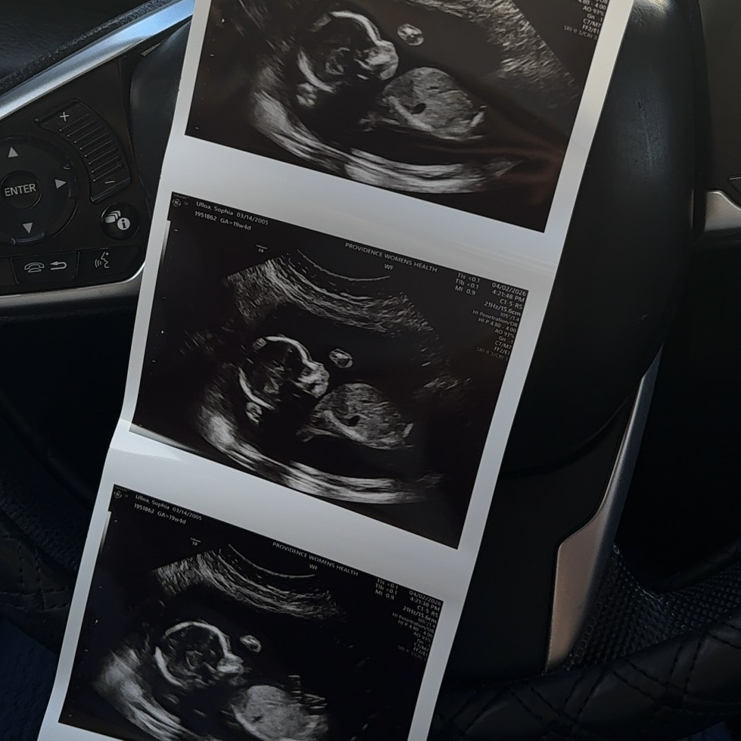 Photo shared by Sophia for their Babylist baby registry.