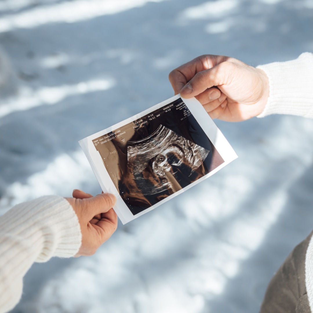 Photo shared by Cherry Ann for their Babylist baby registry.