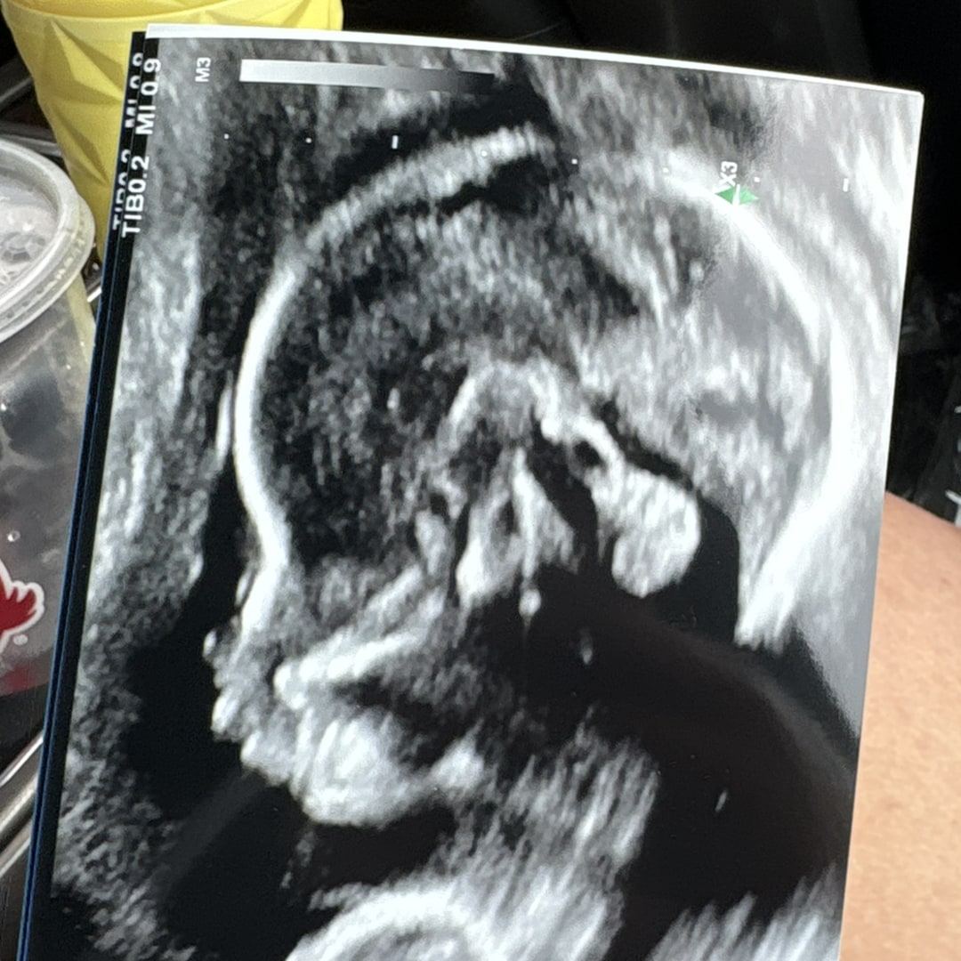 Photo shared by Daphne for their Babylist baby registry.