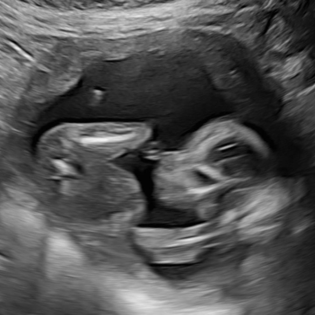 Photo shared by Kaylee for their Babylist baby registry.