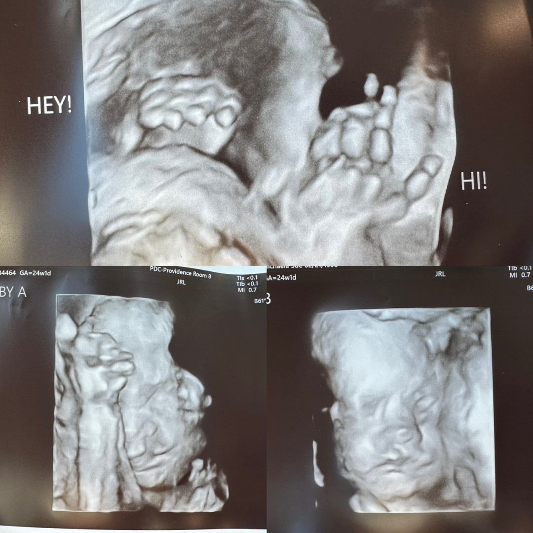 Photo shared by Michaela for their Babylist baby registry.