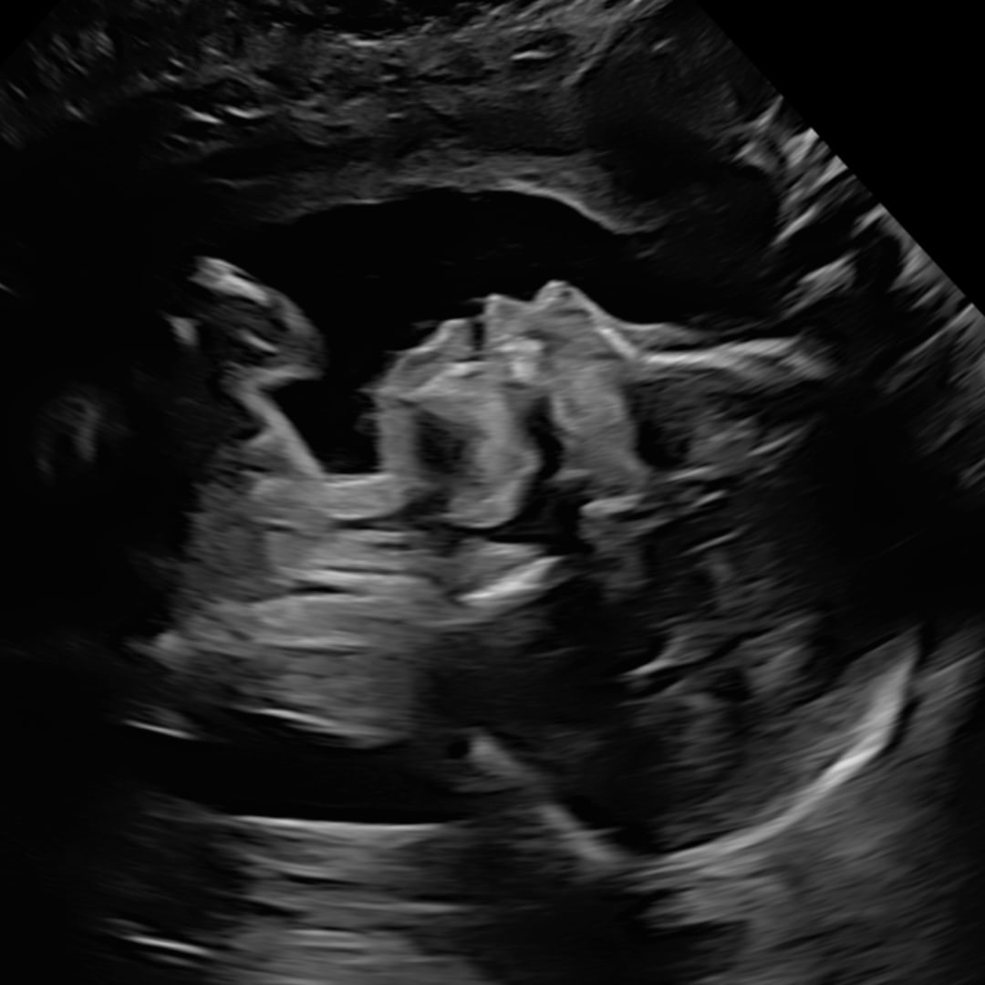 Photo shared by Shannon for their Babylist baby registry.