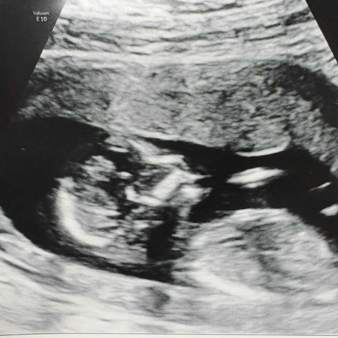Photo shared by Alissa for their Babylist baby registry.