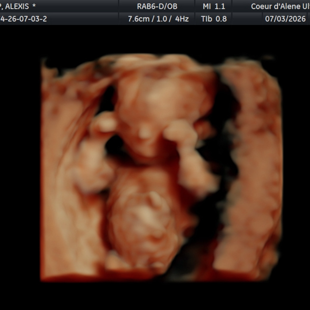 Photo shared by Alexis for their Babylist baby registry.