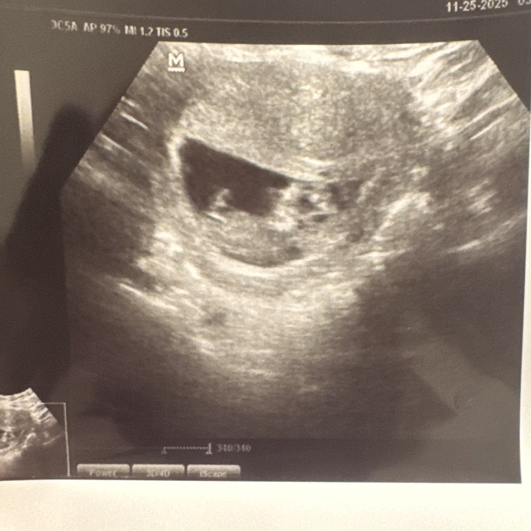 Photo shared by Celeste for their Babylist baby registry.