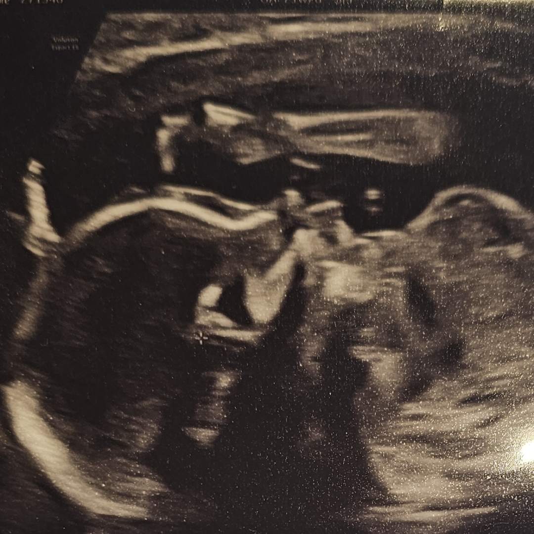 Photo shared by Riley for their Babylist baby registry.