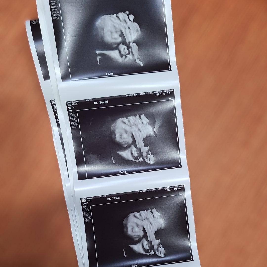 Photo shared by Hannah for their Babylist baby registry.