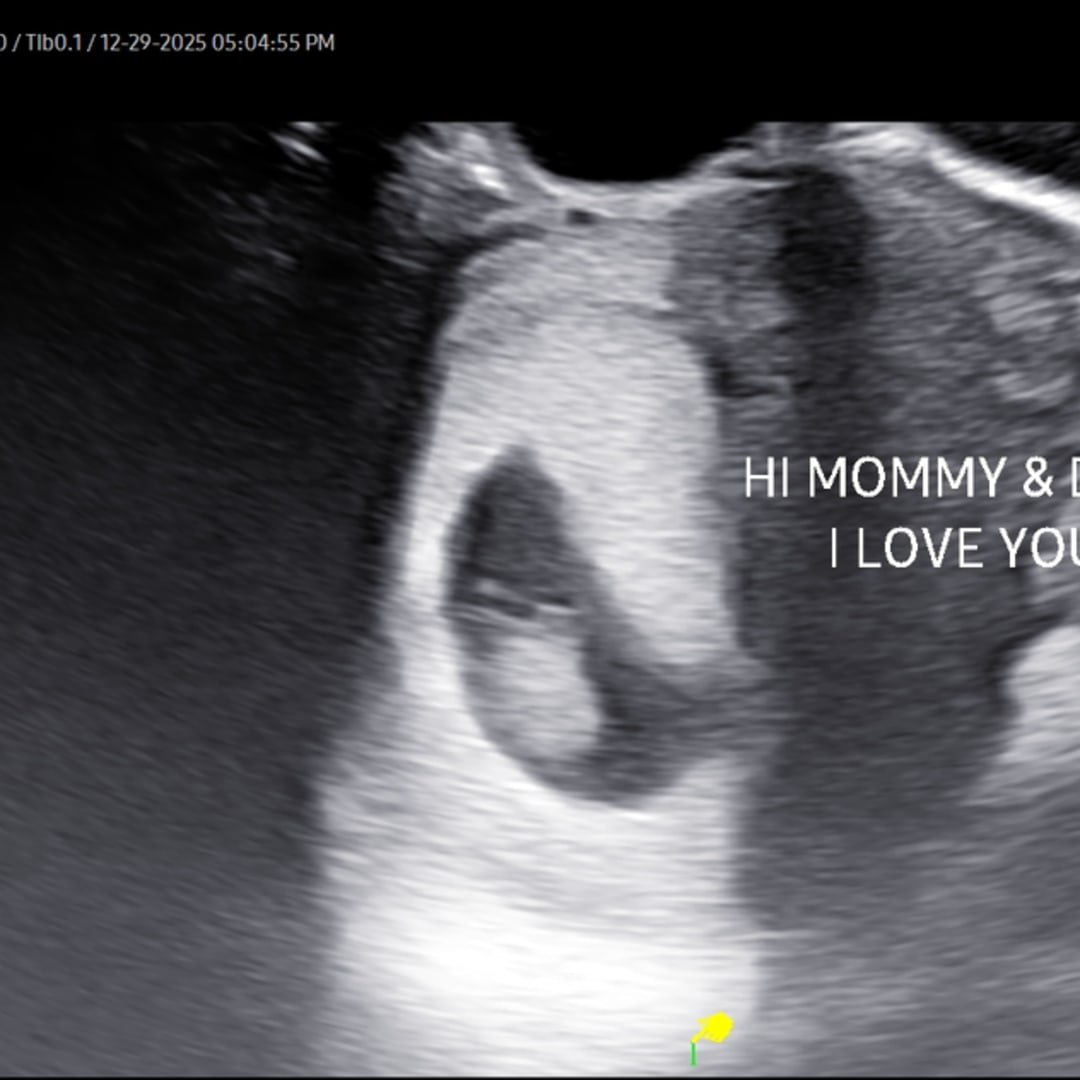 Photo shared by Courtney for their Babylist baby registry.