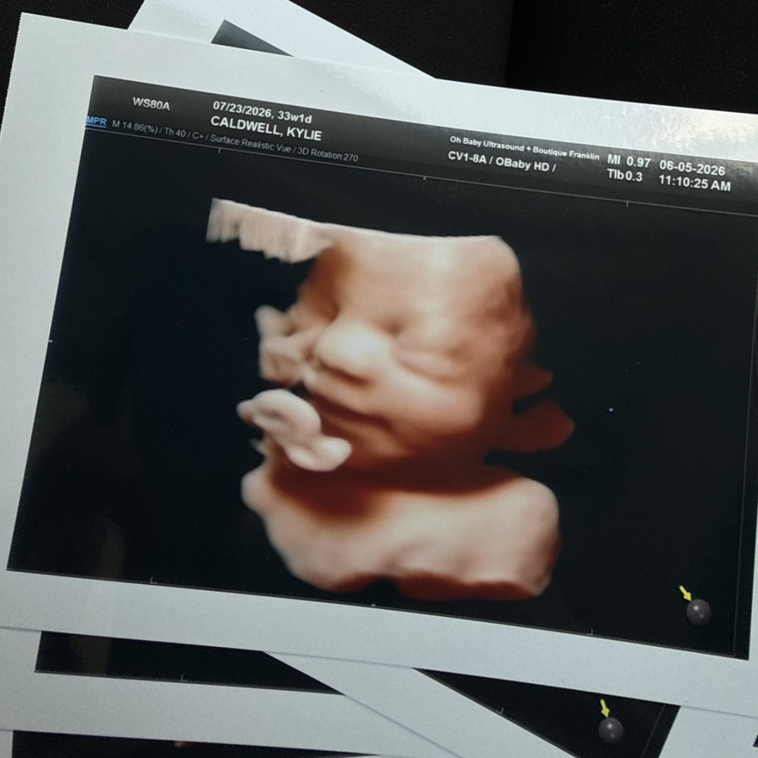 Photo shared by Kylie for their Babylist baby registry.