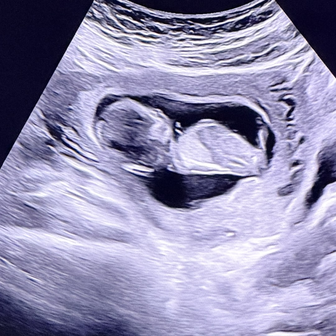 Photo shared by Vixiel for their Babylist baby registry.