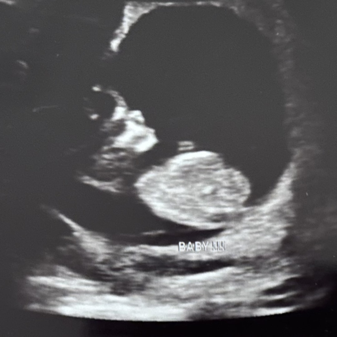 Photo shared by Ashley for their Babylist baby registry.