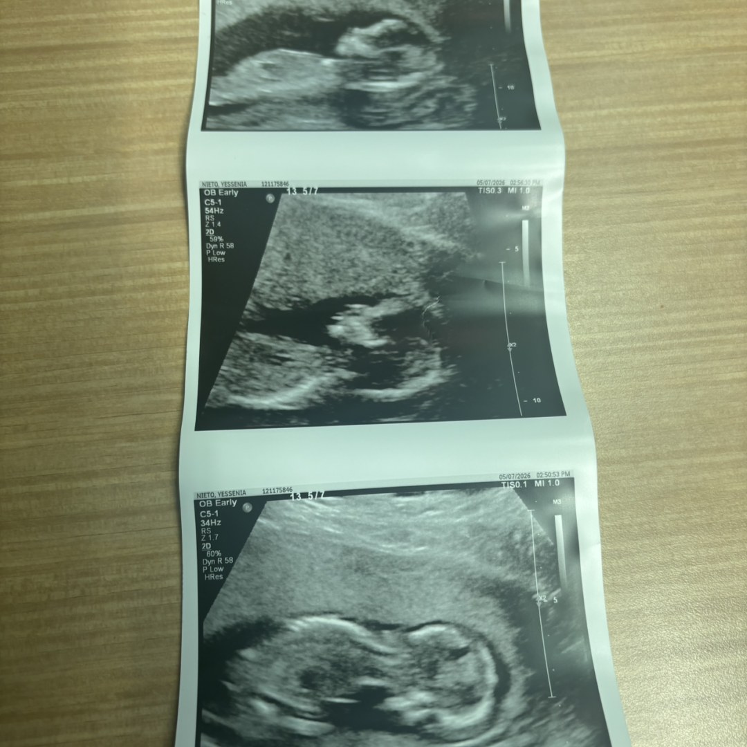 Photo shared by Yessenia for their Babylist baby registry.