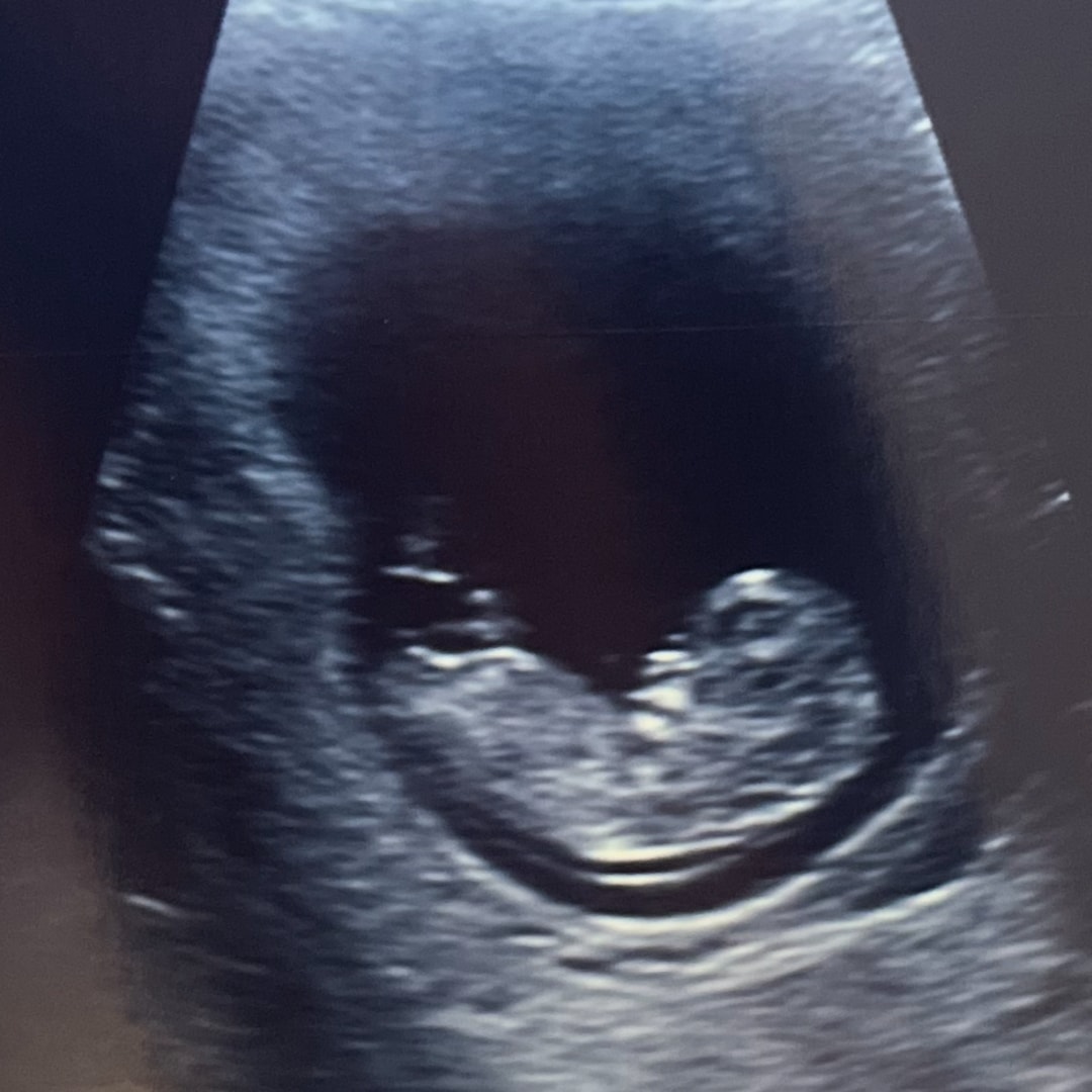 Photo shared by Kiersten for their Babylist baby registry.