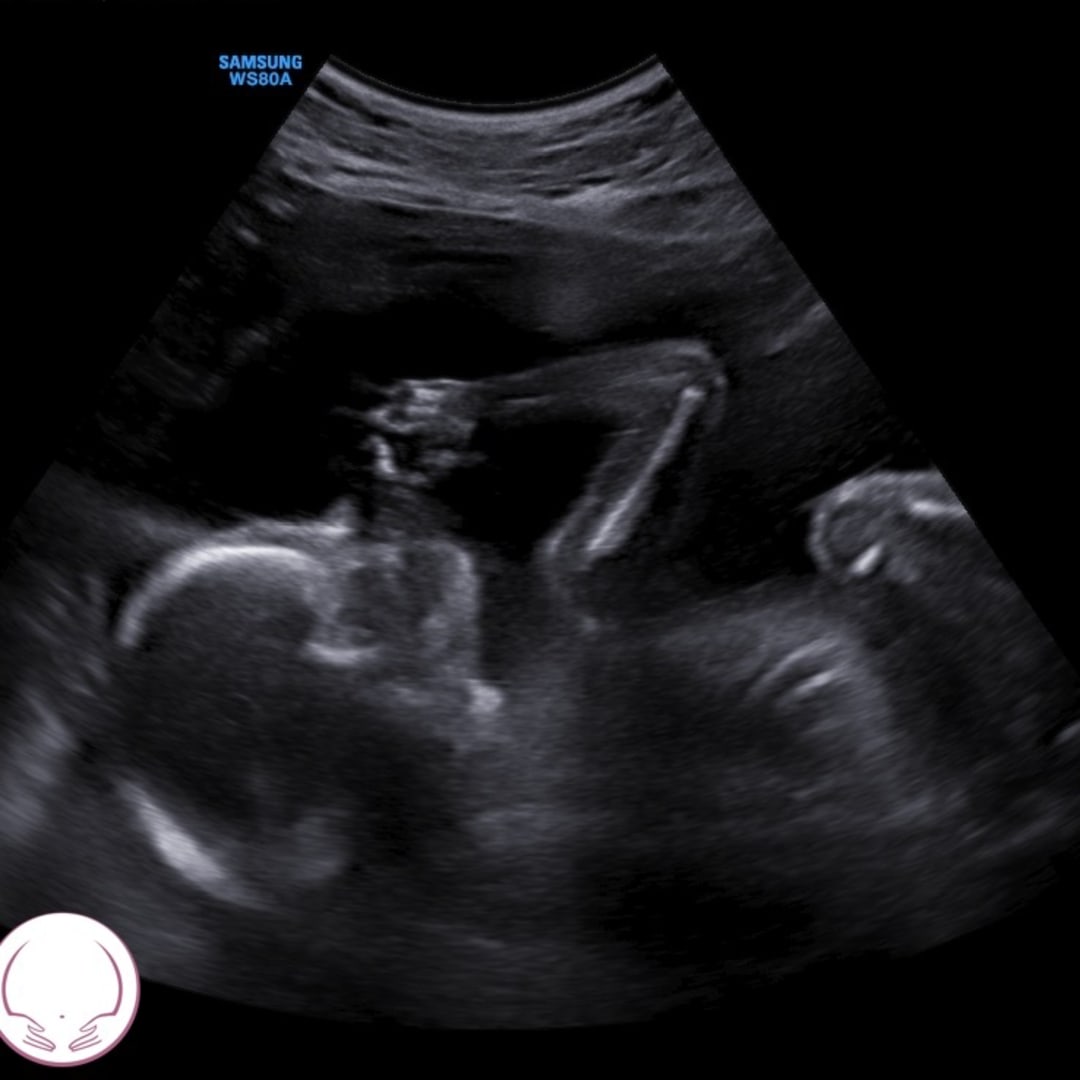 Photo shared by Autumn for their Babylist baby registry.