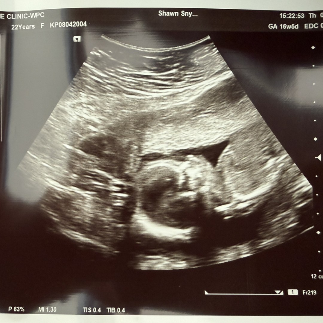 Photo shared by Kirsten for their Babylist baby registry.