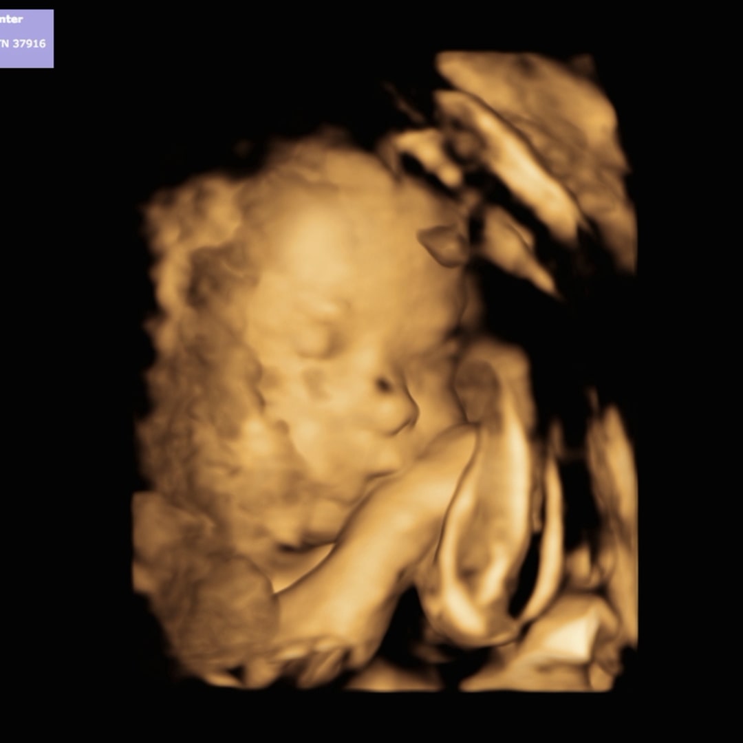 Photo shared by Sydney for their Babylist baby registry.