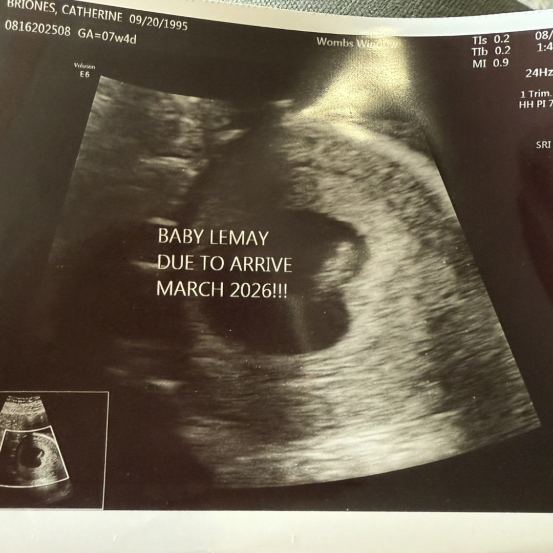 Photo shared by Catherine for their Babylist baby registry.