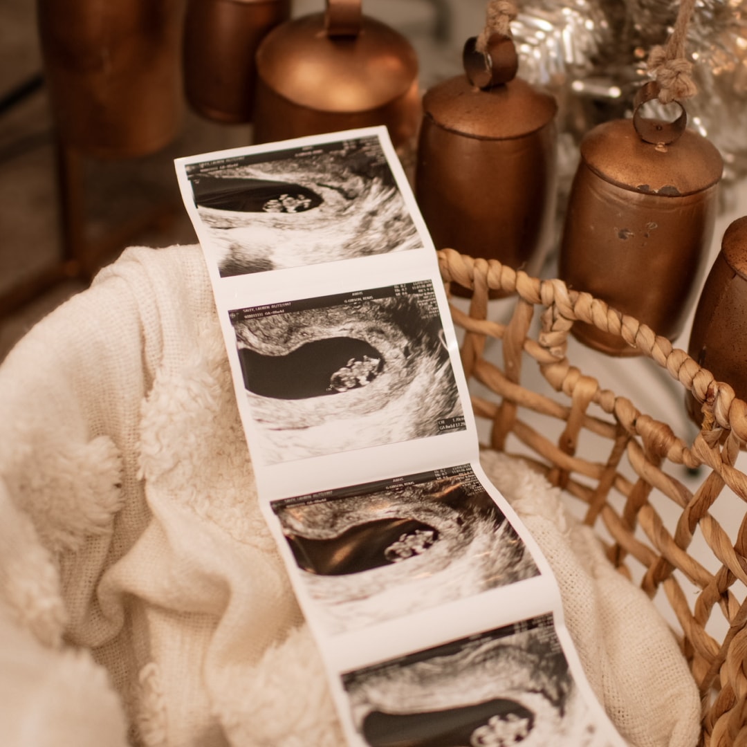 Photo shared by Lauren for their Babylist baby registry.