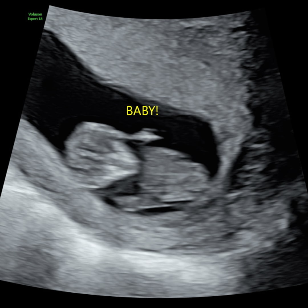 Photo shared by Zaina for their Babylist baby registry.